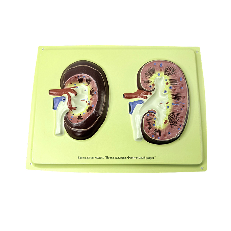 Relief model of human kidney
